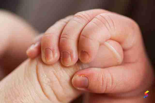 What your nails say about your health - India Today